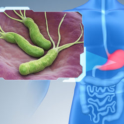 Helicobacter pylori