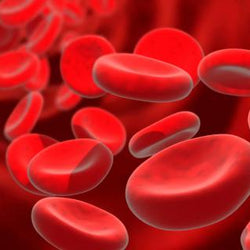 Anemia