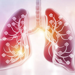 Bronquitis
