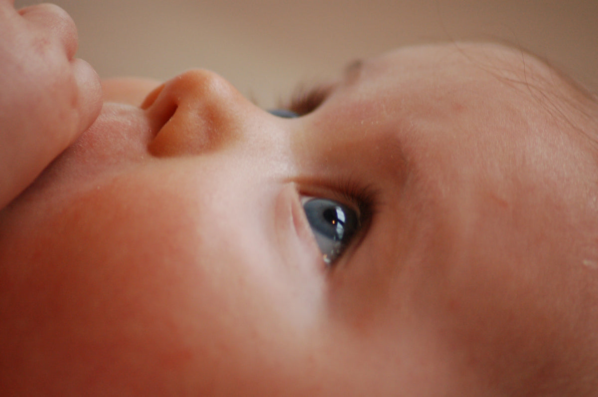 Remedios naturales para la conjuntivitis en bebes
