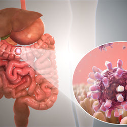 Gastroenteritis
