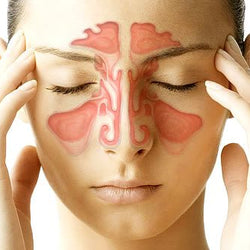 Sinusitis