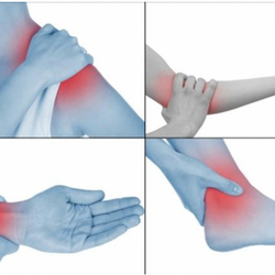Tendinitis