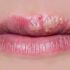 Herpes labial (medicamentos)