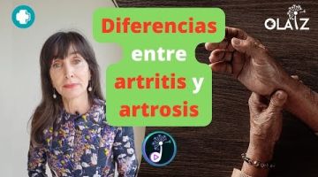 Calma los dolores articulares, artritis, dolor y rigidez por artrosis, lesiones del cartílago...  Ayuda tambien a la formación de tejido conectivo y al mantenimiento de los huesos.Gente que tiene dolor articular, rigidez, deterioro del cartílago...